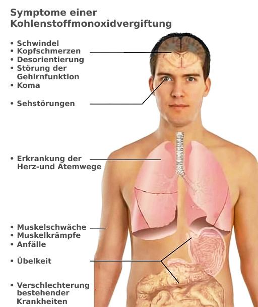 @wikipedia – Intermedichbo / MagentaGreen